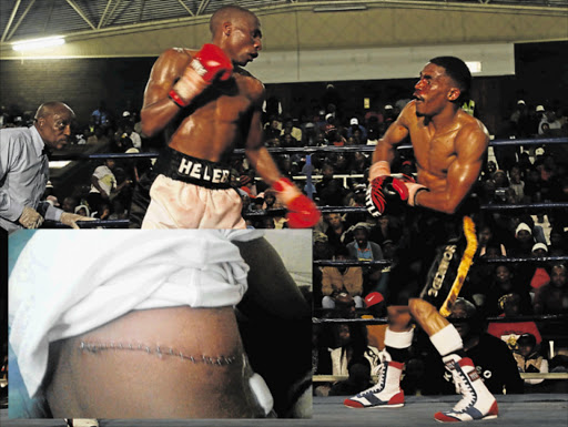 PAINFUL EXPERIENCE: Toto Helebe squares up to Cebo Ngema during their SA title bout at Orient Theatre in East London. INSET: Helebe shows the scar after being stabbed in Cape Town Picture: MICHAEL PINYANA