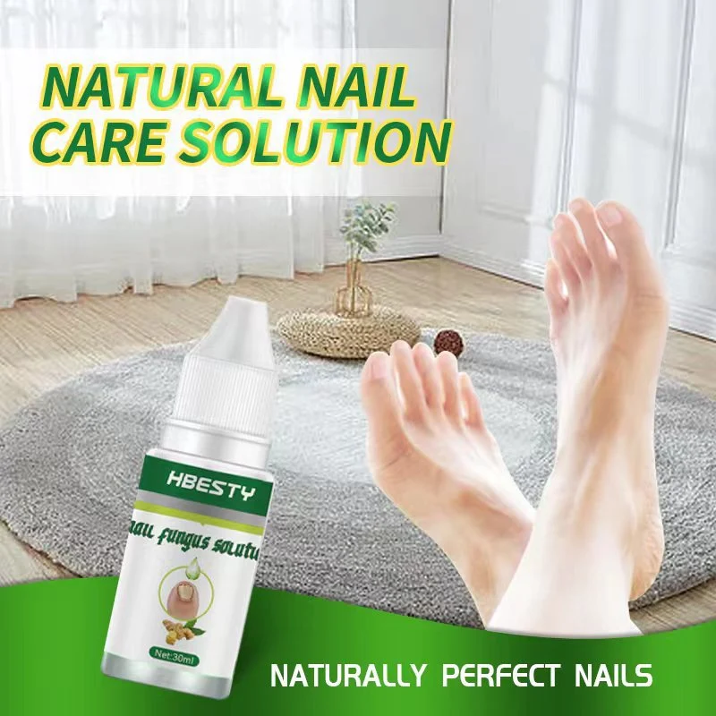 Nagelpilz-Behandlung für Füße & Zehen Nagelpilz Gel Entfernung Anti-Infektion Paronychie Onychomykose Fußpflege Linderung