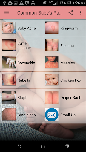 Baby's Rash Guide