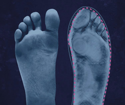 Plantar Fasciitis and Running: Why You’re Not Getting Better