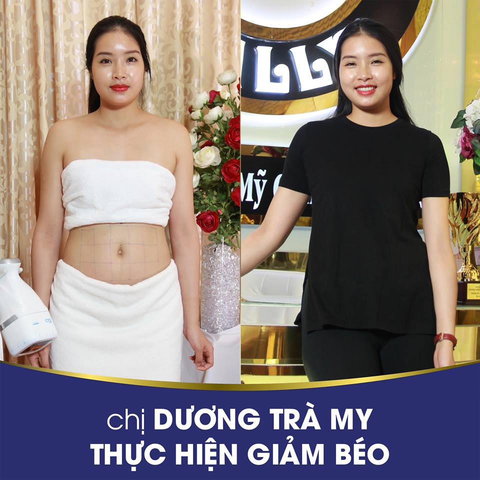 giáº£m má»¡ bá»¥ng hiá»‡u quáº£ nháº¥t khÃ¡ch hÃ ng