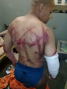 Orapa Qele, one of the inmates said to have been attacked by prison warders in the Eastern Cape, apparently in retaliation for assaulting one of their own. 