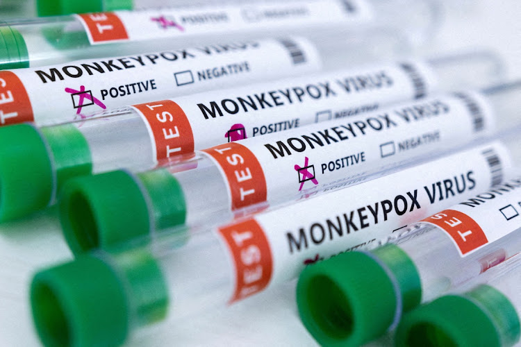 Over 34% of the current global monkeypox case count is in the United States.