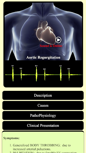 Understand Heart Sounds And Murmurs
