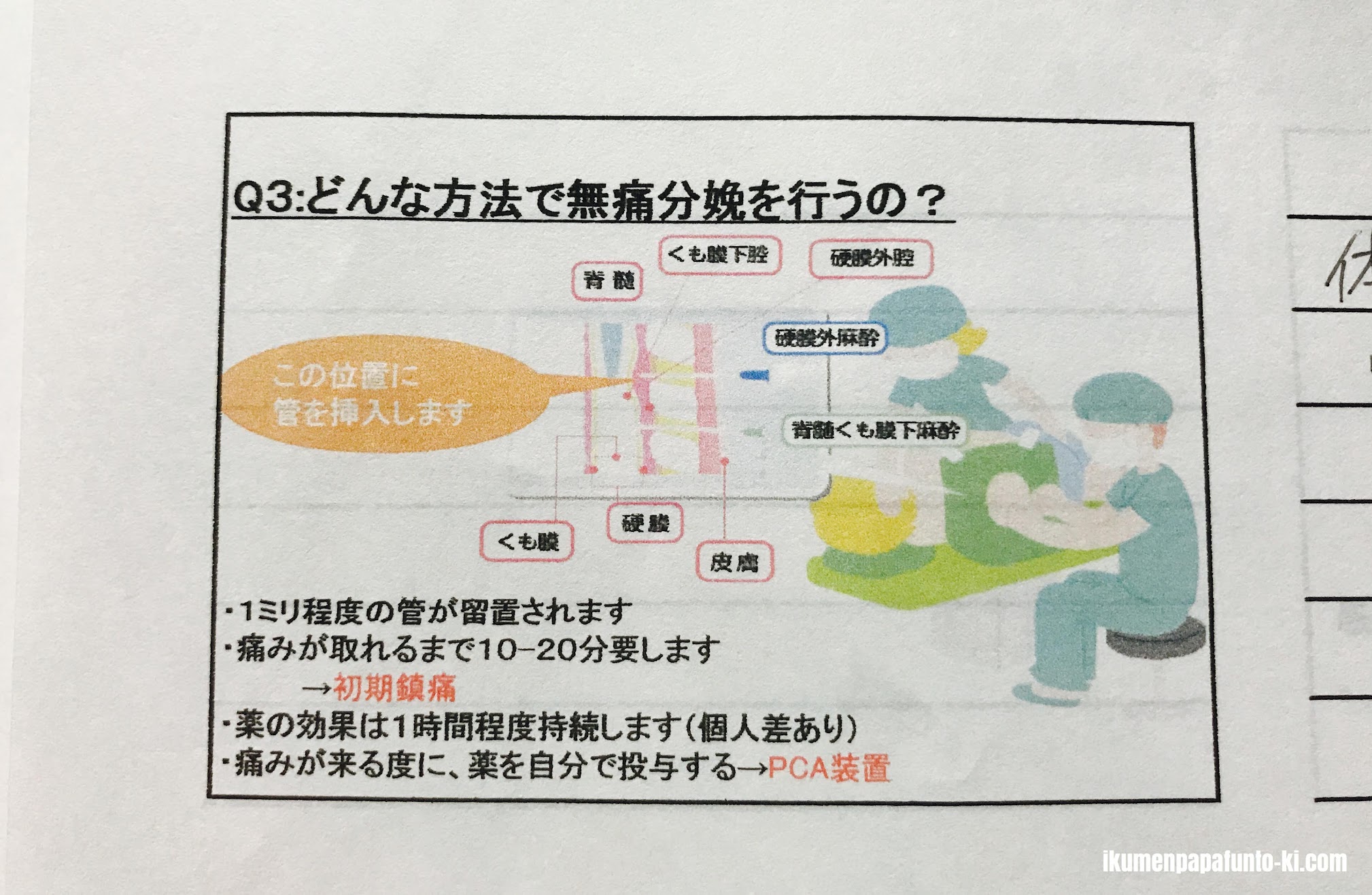 無痛分娩ってすごい...