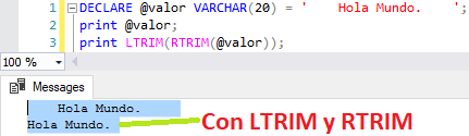 LTRIM y RTRIM en SQL Server