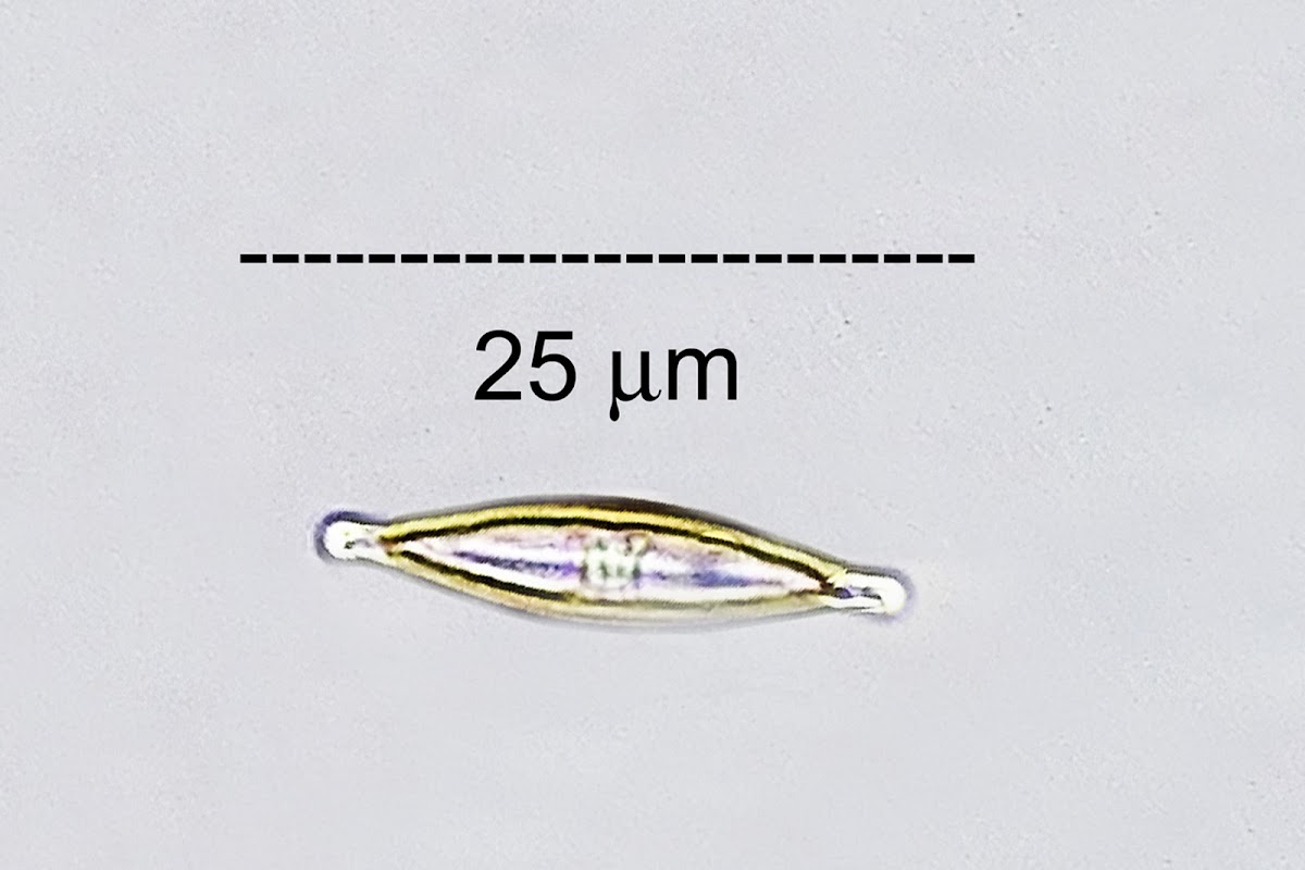 Epilithic Diatom