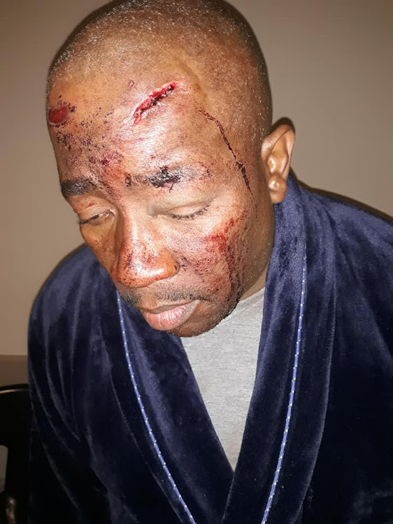 Ngoato had been attacked on Sunday at the Schoemansville Oewer Klub Resort at Hartbeespoort Dam in the North West.