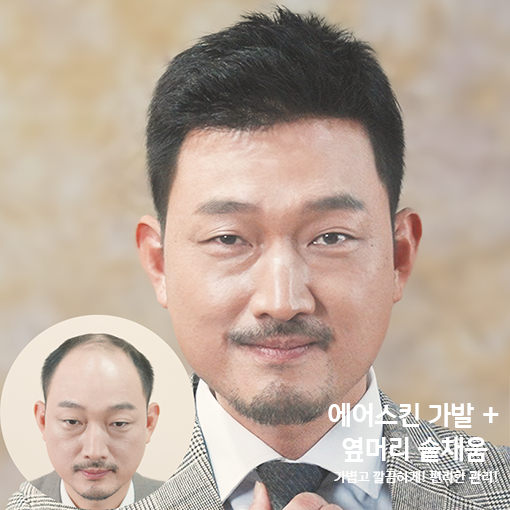 에어스킨_가발_+_옆머리_숱채움_(3)(0001).png