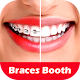 Download Braces Photo Editor 2018 For PC Windows and Mac