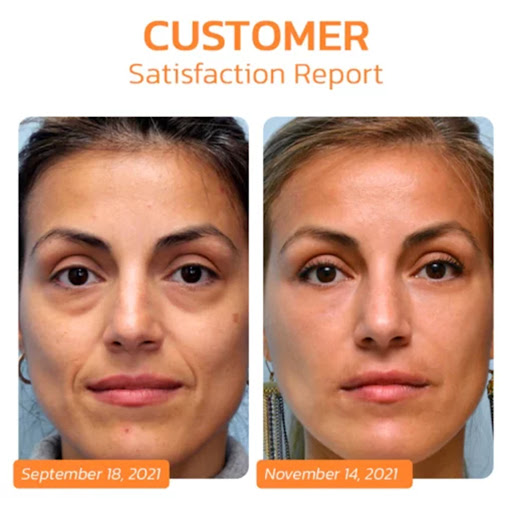 Title 2, Collagen Membrane Nourishes and Firms Skin Ligh...