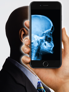 How to mod X-Ray scanning bones (simulation) lastet apk for pc