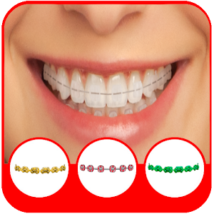 Download Pro Braces Teeth Booth Effects For PC Windows and Mac