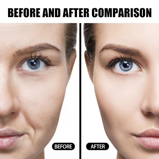 Title 1, Water Bank Filling Anti-wrinkle Cream Moisturiz...