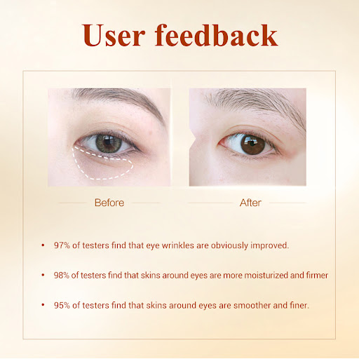 Title 7, Hydrogel Eye Patches