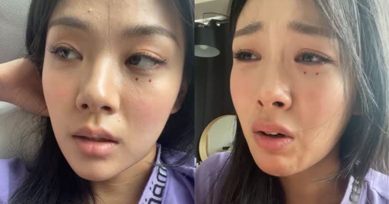 Fans Are Concerned For BIBI\'s Mental And Physical Health After She Breaks  Down On Instagram Live - Koreaboo