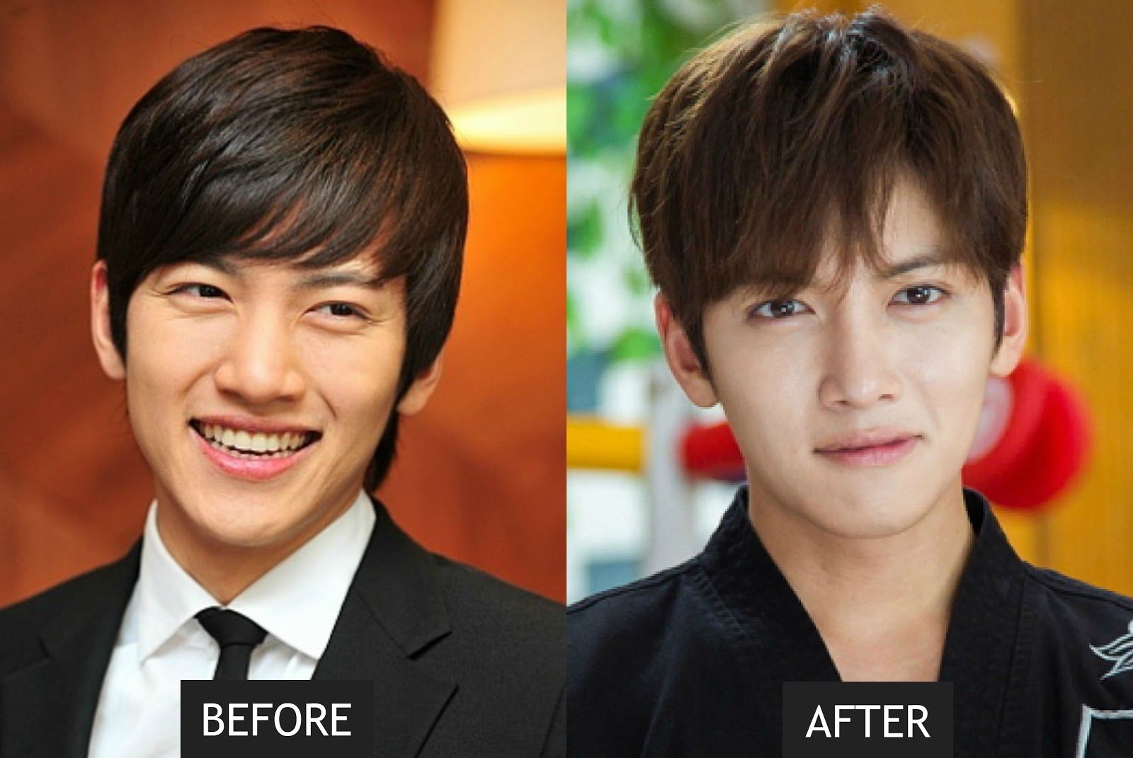 Bts Before And After Plastic Surgery - Korean Idol