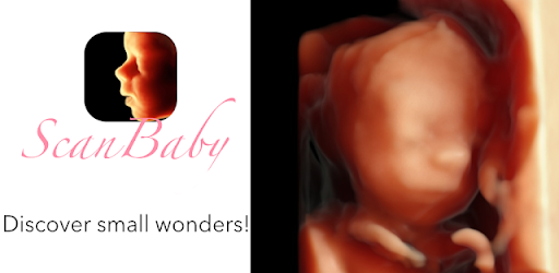 ScanBaby learn baby ultrasound