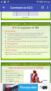 A to Z ECG Interpretation(圖5)-速報App