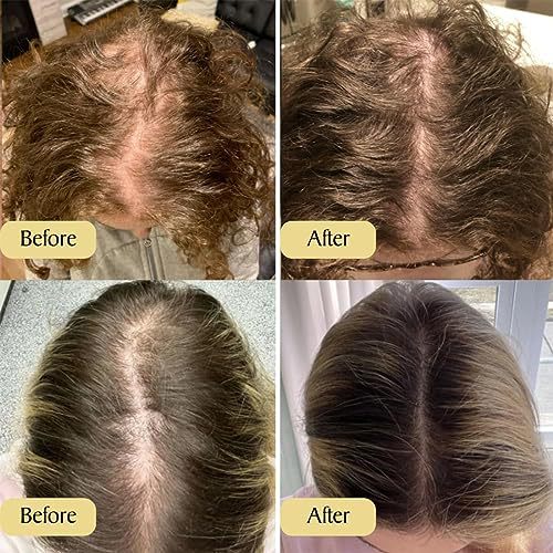 Title 1, Moisturizing Repair Delicate And Soft Hair Care...