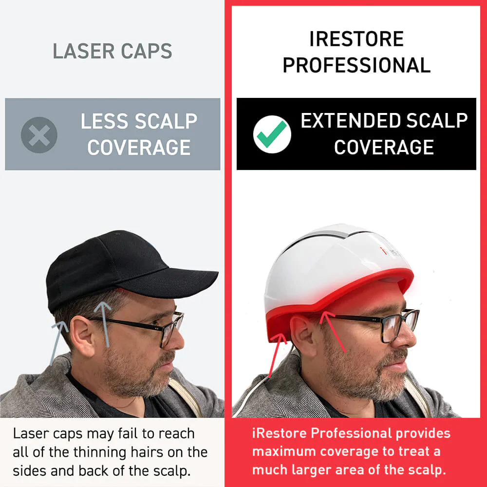 laser caps