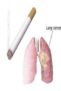 How to download Lung cancer 1.0 apk for bluestacks