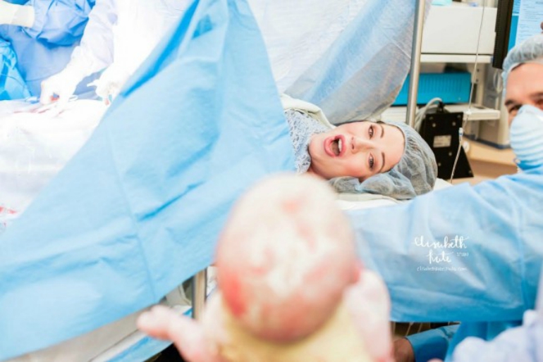 Moms See Their Newborns for the Very First Time