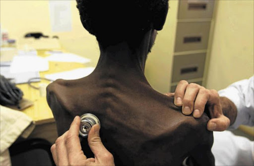 A TB sufferer is examined by a doctor. Academics have attributed 5.6 years of the life expectancy gap in HIV negative people to the higher TB mortality rate among men. Picture: JAMES OATWAY