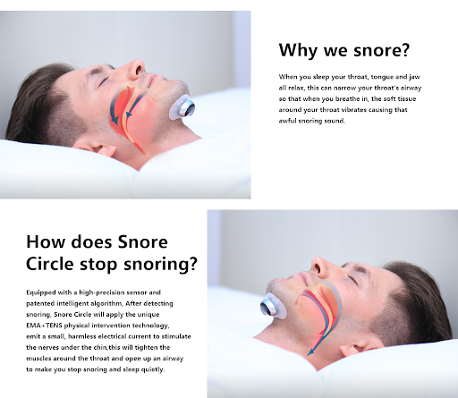 Title 2, Smart Anti Snoring Device Electronic Muscle Sti...