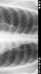 Free XRay Scanner Prank SA APK