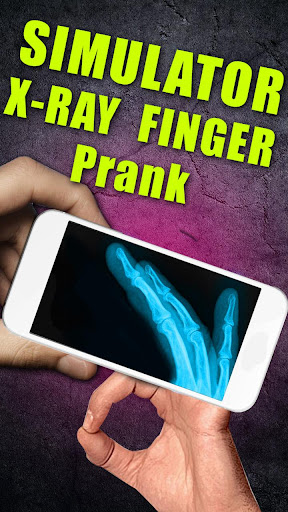 Simulator X-Ray - Finger Prank