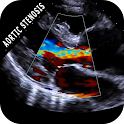 AORTIC STENOSIS PROTOCOL GUIDE