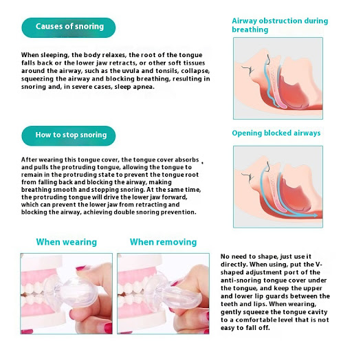 Title 4, Silicone Tongue Anti-Snoring Device Sleeping Ai...