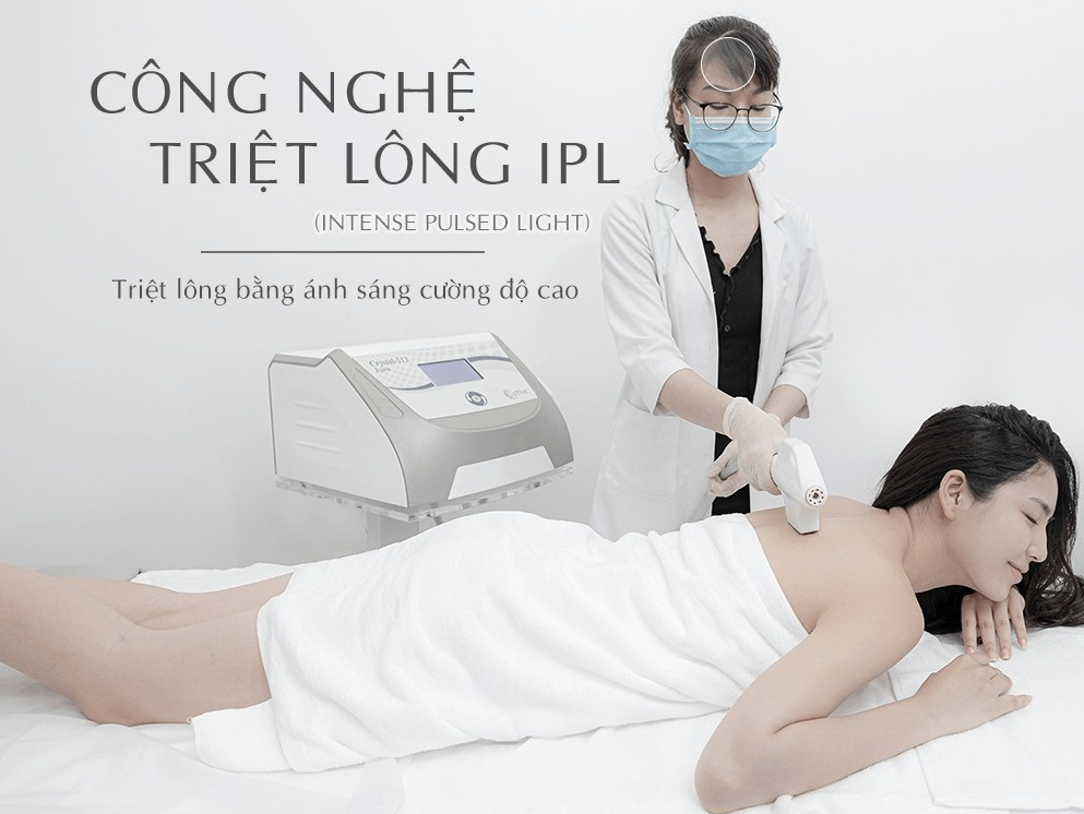 cong-nghe-triet-long-ipl