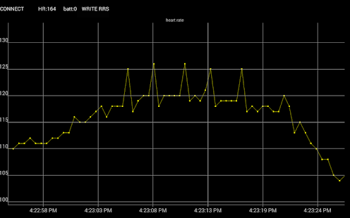 Free Arrhythmia monitor open source APK