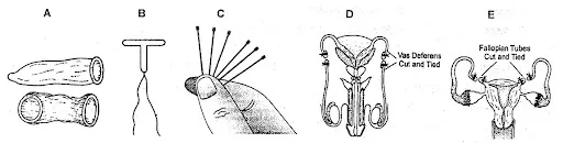 Method of birth control