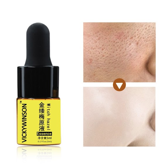 Tinh Chất Hazel Tẩy Tế Bào Cấp Ẩm Se Khít Lỗ Chân Lông Làm Sạch Sâu 5Ml