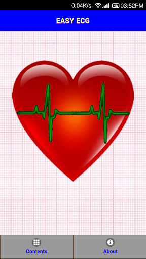 Easy ECG