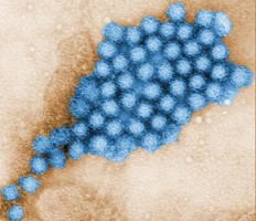 Transmission electron micrograph (TEM) image of some of the ultrastructural morphology displayed by norovirus virions, or virus particles.