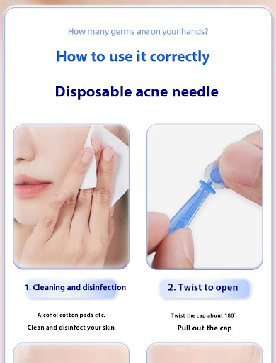 Title 7, Beauty Salon Disposable Acne Pimple Pin