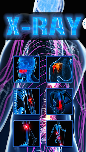 Xray Scanner Prank