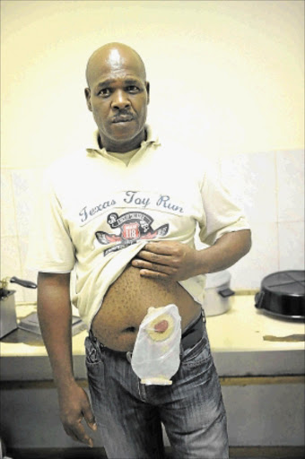 TURNED AWAY: Anthony Ramothale could not be treated at Charlotte Maxeke Hospital because a machine had not been repaired. PHOTO: Tsheko Kabasia