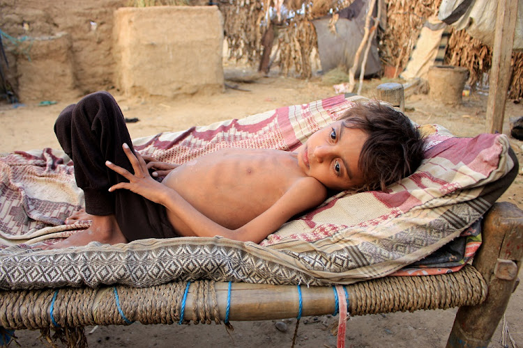 Hassan Merzam Muhammad lies on a bed at his family's hut in Hajjah province, Yemen. This picture was taken on November 23 2020.