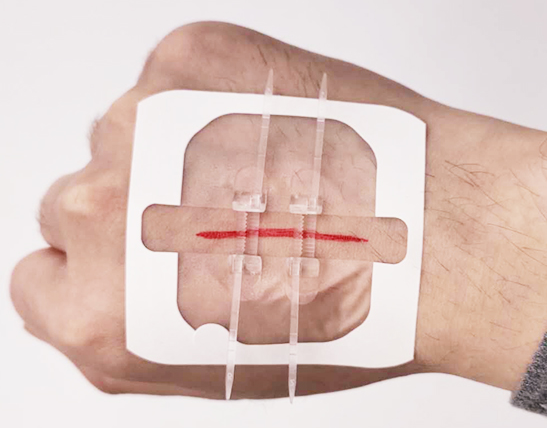 Title 8, Zipper bandage wound suture patch Close wounds ...