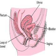 Surgery Umblical Hernia  Icon