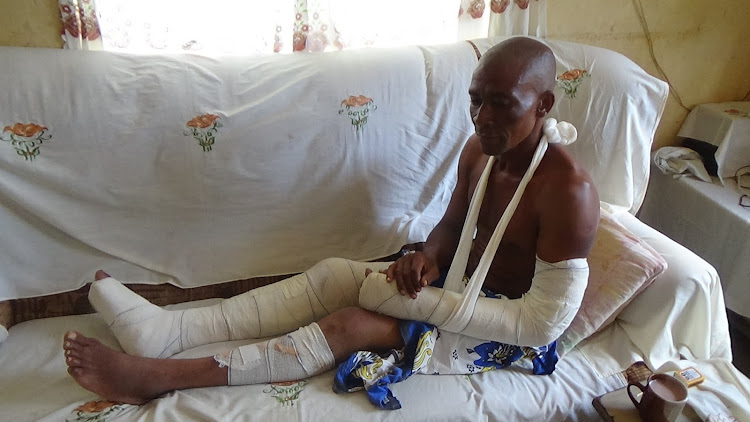 Lincoln Nzunza who was allegedly beaten up by police and left with a broken arm and leg at Matinyani police station;