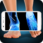 Cover Image of Tải xuống Xray Fracture Foot Prank 1.3 APK