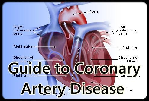 免費下載醫療APP|Guide Coronary Artery Disease app開箱文|APP開箱王