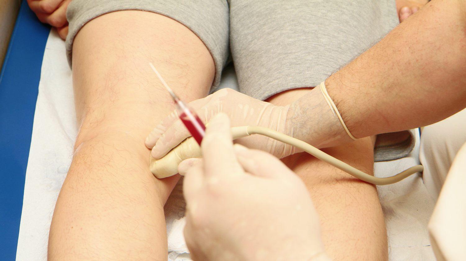 Prolotherapy and PRP tennis Elbow Injections - Advanced Chiropractic Spine  & Sports Medicine