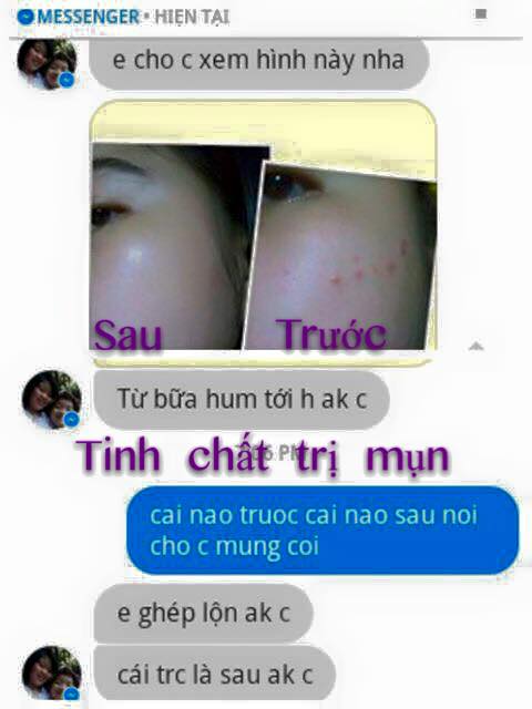 kem tri mun trung ca